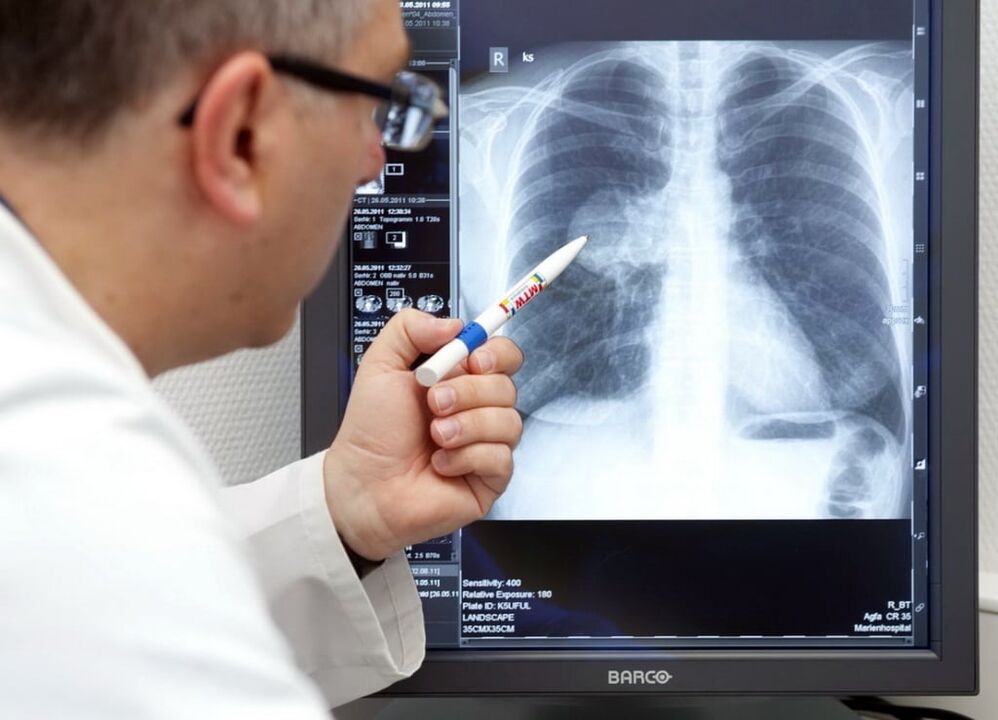 diagnose van arteriële hypertensie